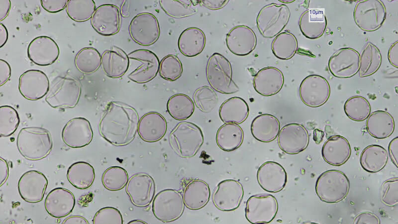 Il moto browniano: dalla fisica molecolare alla finanza quantitativa Processed Urtica dioica pollen magnified 40 times under microscope